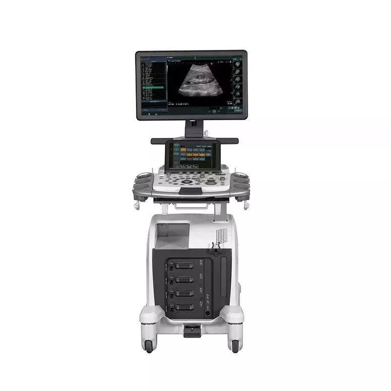 Ultrasonograf Arietta 65