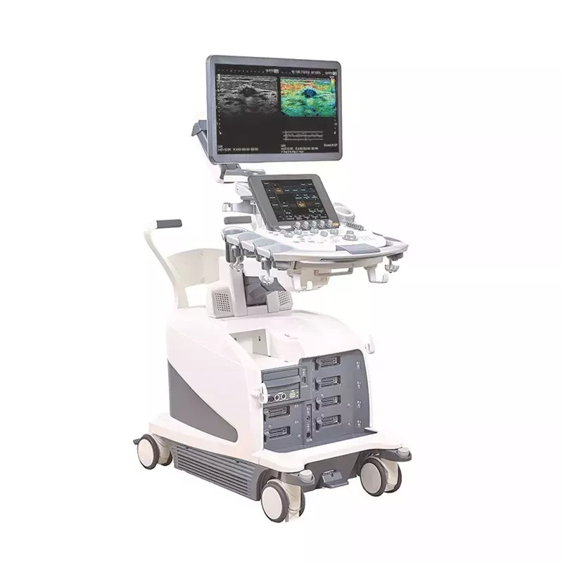 Ultrasonograf Arietta 750